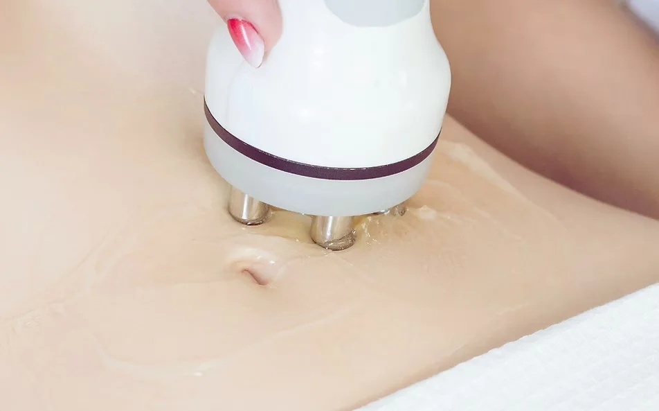 Face RF treatment
